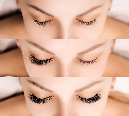 Latisse for Eyelashes