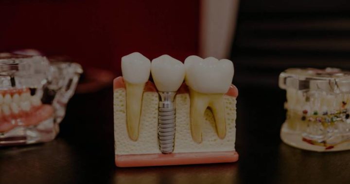 teeth scaling service in Dwarka