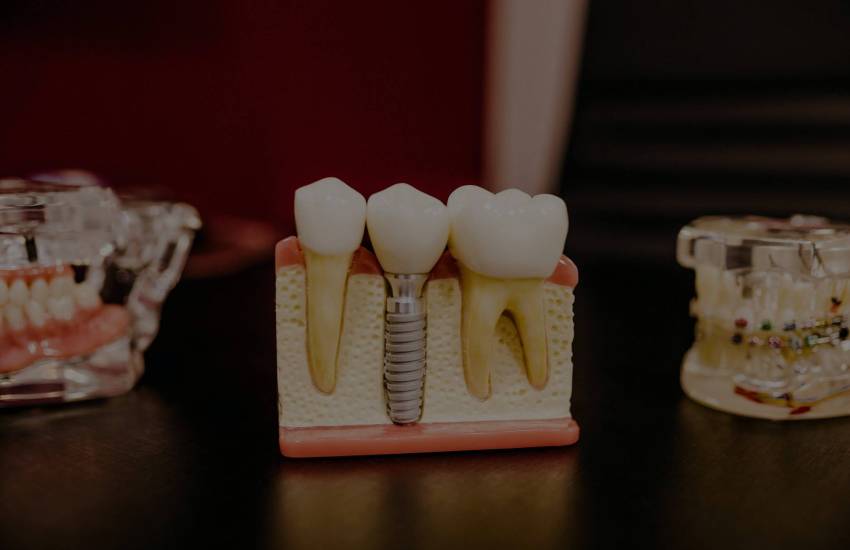 teeth scaling service in Dwarka