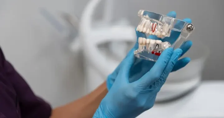 All-On-X Dental Implants In Pembroke Pines